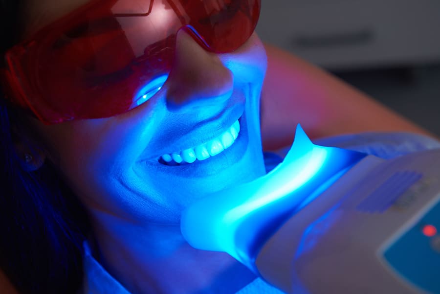A woman with a dental device, smiling brightly, showcasing her teeth.