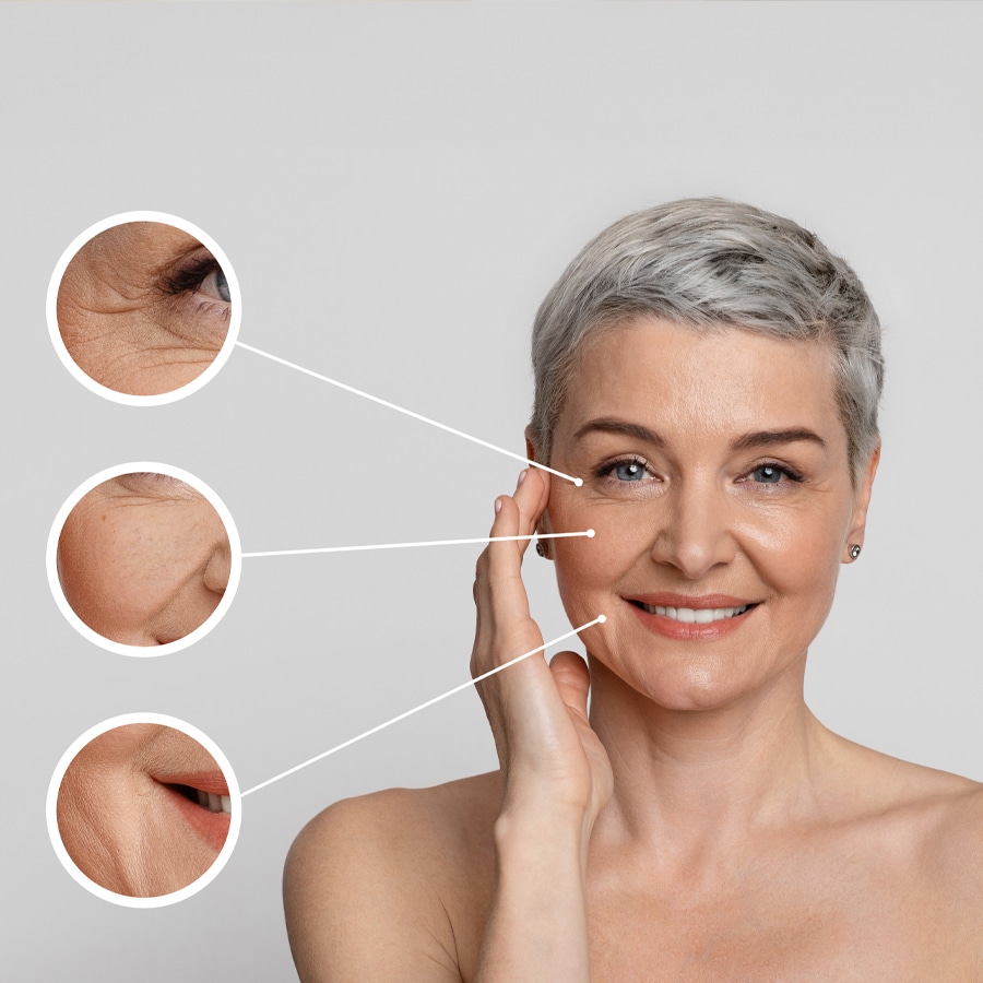 A woman displaying facial wrinkles, emphasizing the skin benefits of Halotherapy and Red Light Therapy at iVee Restorative Care.