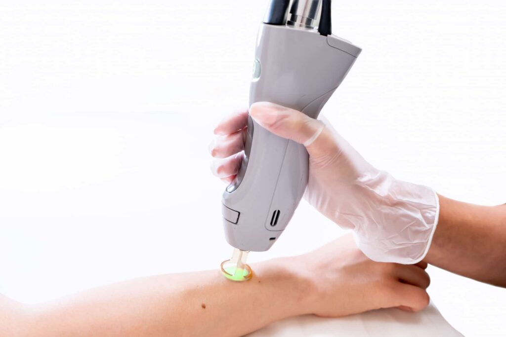 A person applying an electric device for hand treatment, showcasing the innovative ivee restorative care technology.